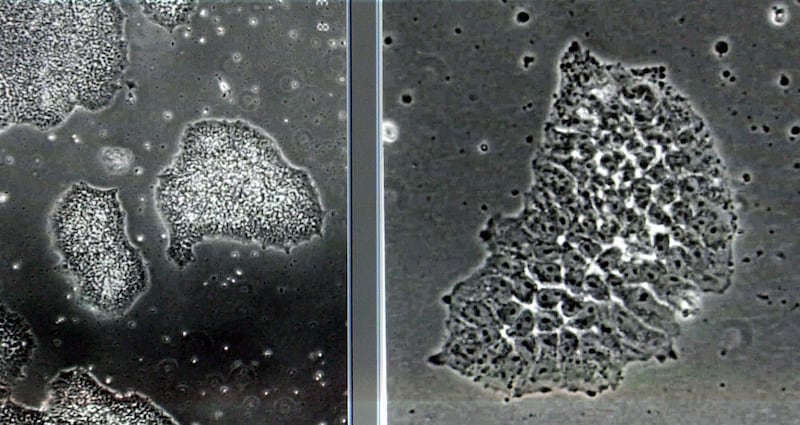 Stem cells in clusters.
