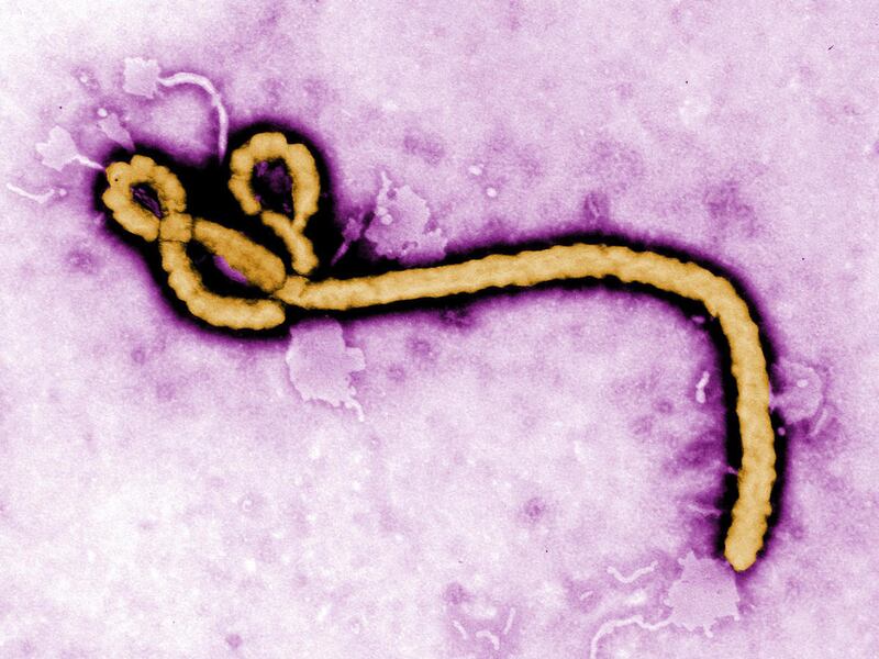 FILE - In this undated colorized transmission electron micrograph file image made available by the CDC shows an Ebola virus virion. For the first time, Ebola has been discovered inside the eyes of a patient months after the virus was gone from his blood,