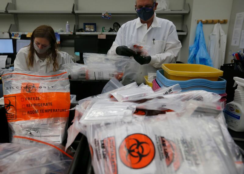 Photo of COVID-19 test specimens.