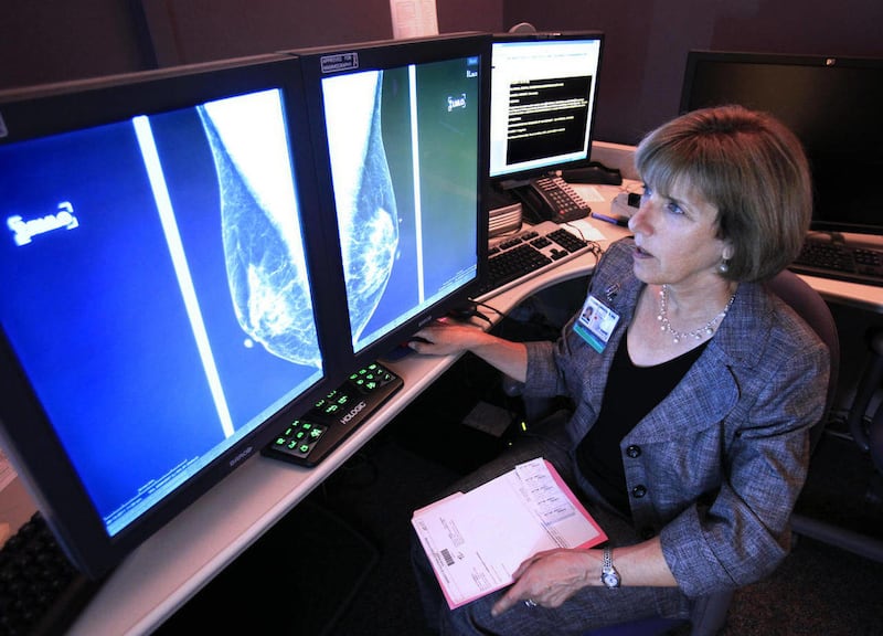 ln this photo taken Wednesday Sept. 14, 2011, Dr. Karen Lindsfor, a professor of radiology and chief of breast imaging at the University of California, Davis Medical Center, examines the mammogram of a patient with heterogeneously dense breast tissue, in