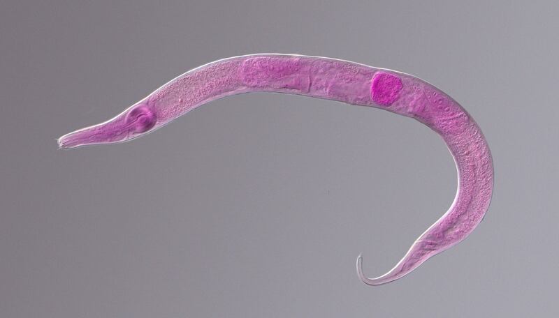 A Nematode roundworm is shown on a microscope slide.