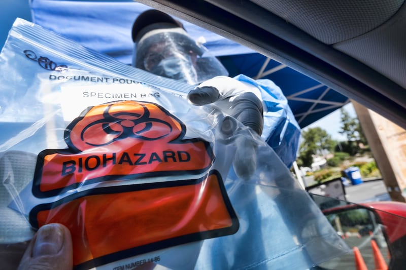 In this May 6, 2020 photo a medical worker hands a self administered coronavirus test to a patient at a drive through testing site in a parking lot in the Woodland Hills section of Los Angeles. California’s death count from the coronavirus surpassed 15,000 on Sunday, Sept. 20, even as the state saw widespread improvement in infection levels.