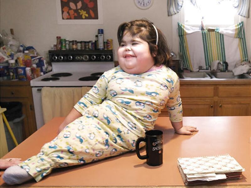 Shiloh Pepin is seen in 2007 laughing with family at home in Kennebunkport, Maine. She was born with fused legs.