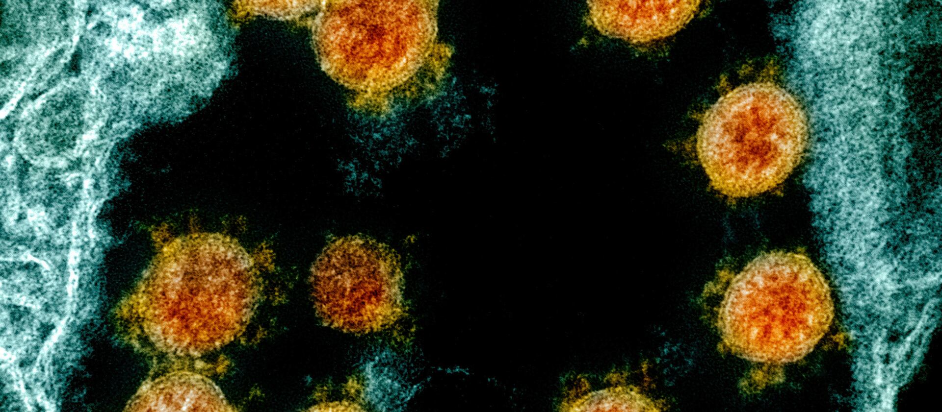 Coronavirus SARS-CoV-2 virus particles, orange, isolated from a patient.