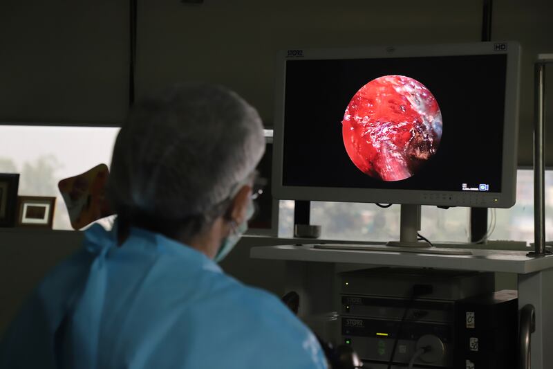 Indian doctor B.P Tyagi performs extended functional endoscopic sinus surgery on a person suffering from mucormycosis at a hospital in Ghaziabad, outskirts of New Delhi, India.