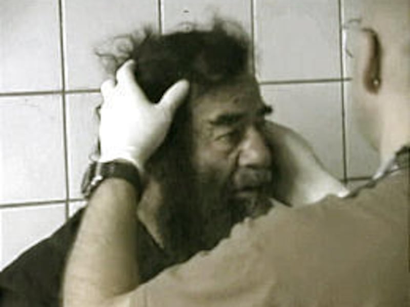 Saddam Hussein undergoes a medical examination in Baghdad. The cowed, captured Saddam contrasts sharply from the arrogant dictator.
