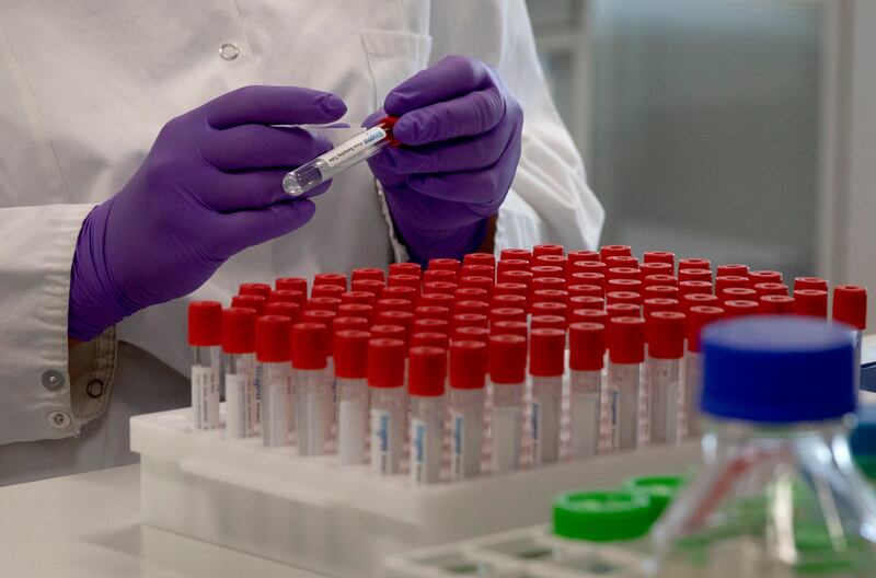 A lab technician puts a label on a test tube during research on coronavirus, COVID-19, at Johnson & Johnson subsidiary Janssen Pharmaceutical in Beerse, Belgium, on Wednesday, June 17, 2020.