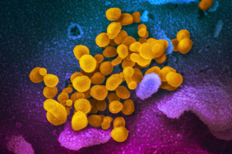 This undated electron microscope image made available by the U.S. National Institutes of Health in February 2020 shows the Novel Coronavirus SARS-CoV-2, yellow, emerging from the surface of cells, blue/pink, cultured in the lab. The sample was isolated from a patient in the U.S.