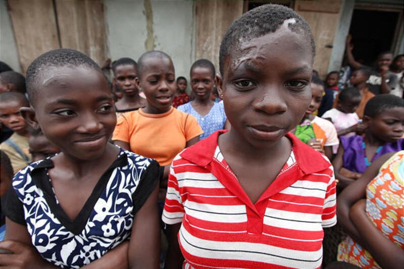 Bearing scars, Jane, left, and Mary stand outside a shelter in Eket, Nigeria, with other abandoned children accused of witchcraft.