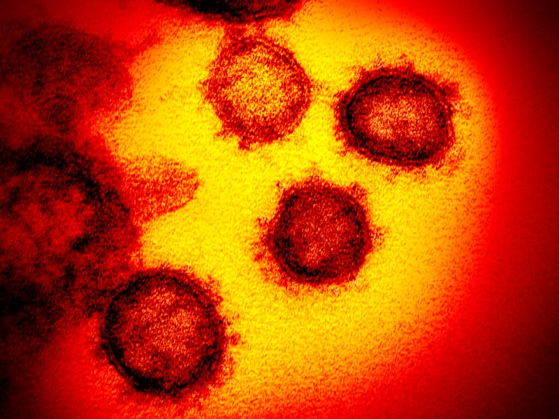 The virus that causes COVID-19.