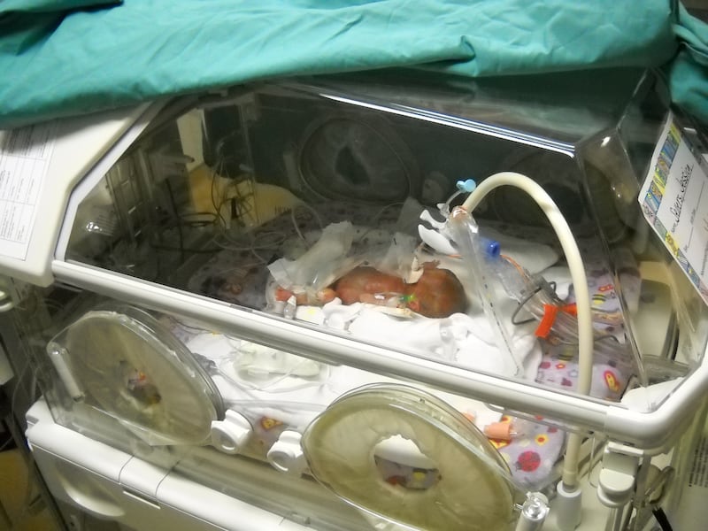 Quinn Sellers, born at 25 weeks' gestation, in the neonatal intensive care unit at Intermountain Medical Center on her second day of life. She remained in the NICU for 20 weeks.