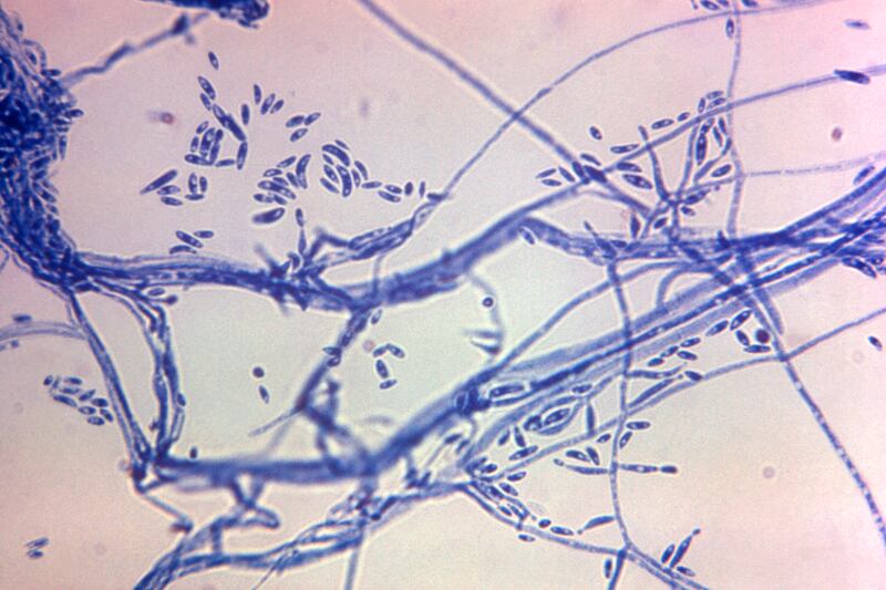 This microscope photo provided by the Centers for Disease Control and Prevention shows a Fusarium sp. fungal organism in 1972.