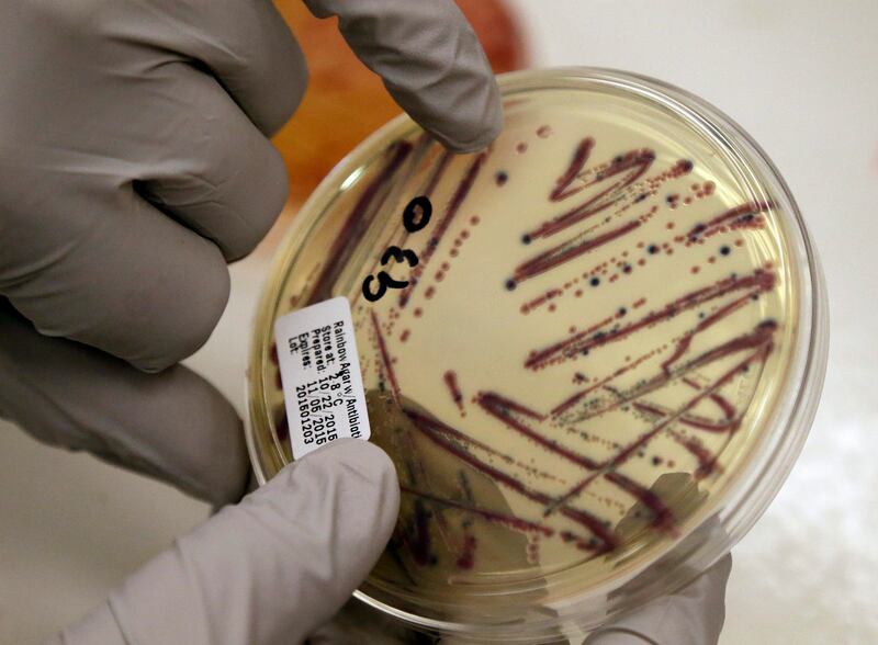 A microbiologist points out an isolated E. coli growth on an agar plate from a patient specimen.
