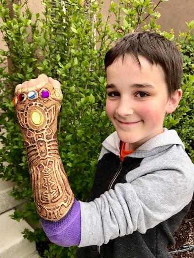 A look at Seth Anderson with his cast.