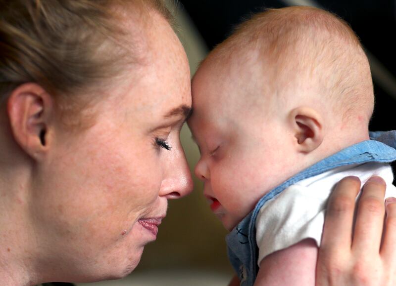 Stephanie Benton holds her son, Milo, as he gets sleepy before his afternoon nap at their Salt Lake City home on Tuesday, March 12, 2019. Stephanie and her husband, Adam, did not know Milo had Down syndrome until he was a couple of hours old. Now they're