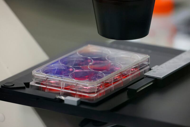 Samples are pictured in a laboratory at the Valneva headquarters.