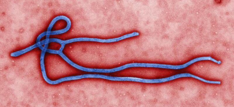 This photo provided by the CDC shows an ebola Virus. U.S. health officials are monitoring the Ebola outbreak in Africa but say the risk of the deadly germ spreading to the United States is remote.