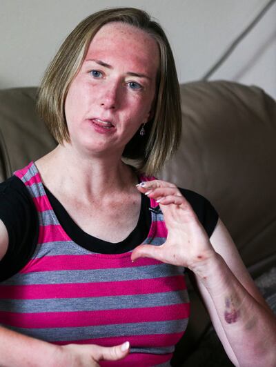 Dawn Rohde details how a holiday trail run turned into a harrowing overnight ordeal, beginning with a decision to leave the well-marked trail she’d planned to run the morning of July 4, during an interview at her home in Cottonwood Heights on Sunday, July