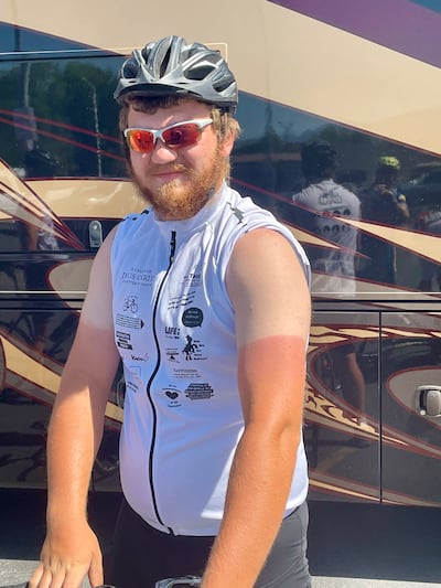 Zach Bowers shows off his tan line and sunburned arms after a 300-mile bike ride from Lehi to St. George, Utah.