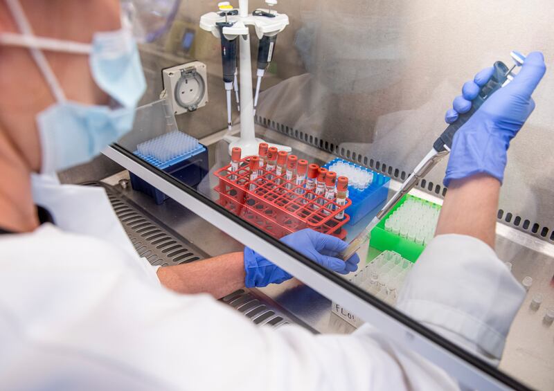 In this handout photo released by the University of Oxford samples from coronavirus vaccine trials are handled inside the Oxford Vaccine Group laboratory in Oxford, England Thursday June 25, 2020.