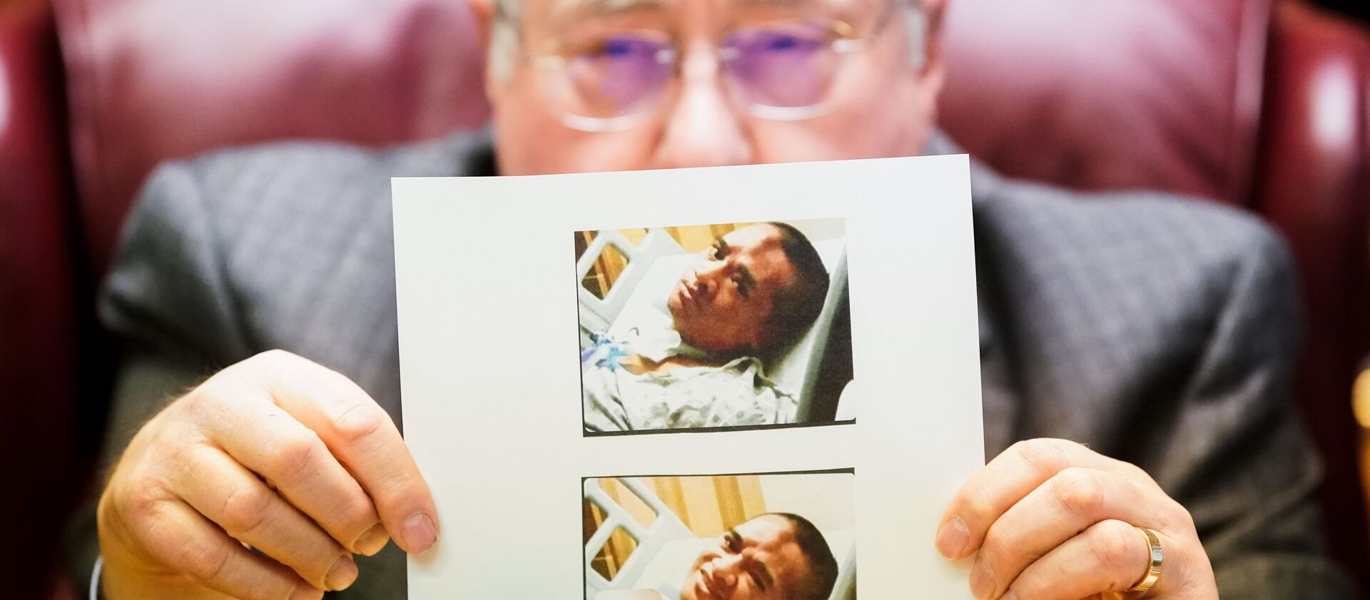 Lawyer Robert B. Sykes shows a recent photograph of Atonio Sivatia, taken in the hospital, during a press conference.