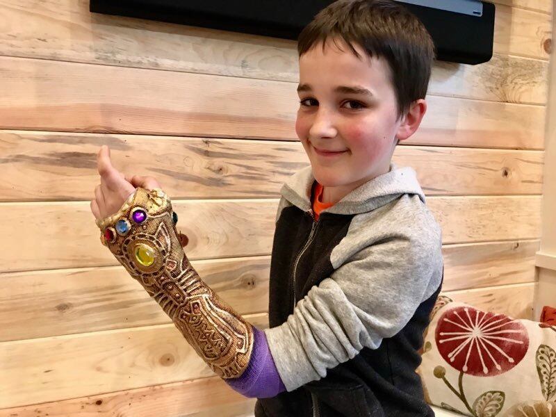 Seth Anderson attempting the Thanos Snap in his new cast.