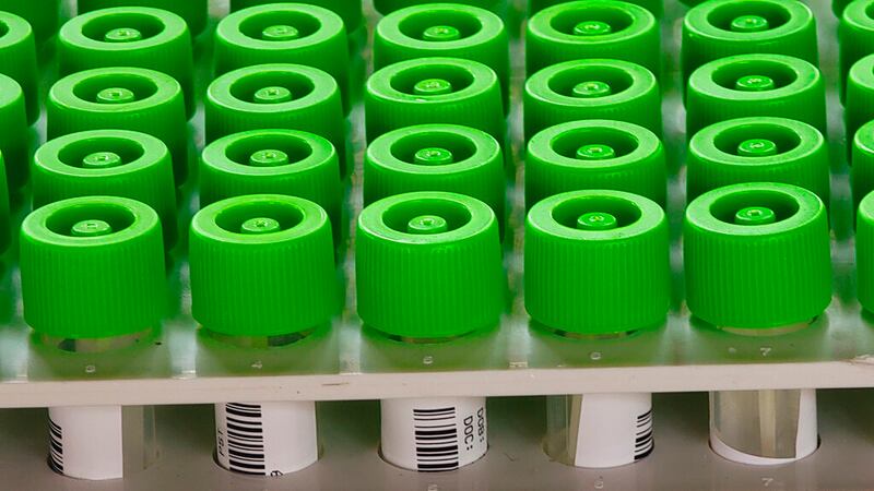 Vials of COVID-19 PCR tests.