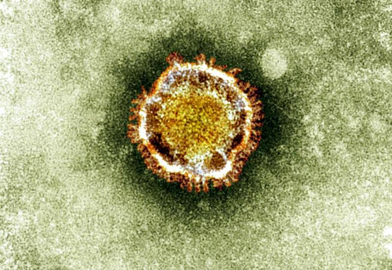FILE - This undated file image released by the British Health Protection Agency shows an electron microscope image of a coronavirus, part of a family of viruses that cause ailments including the common cold and SARS, which was first identified last year i