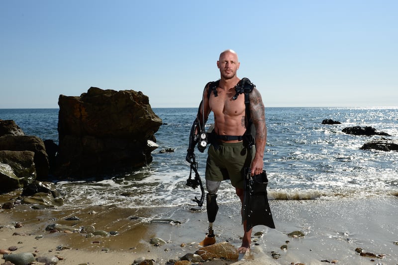 Paul de Gelder lost his right leg and forearm in a bull shark attack