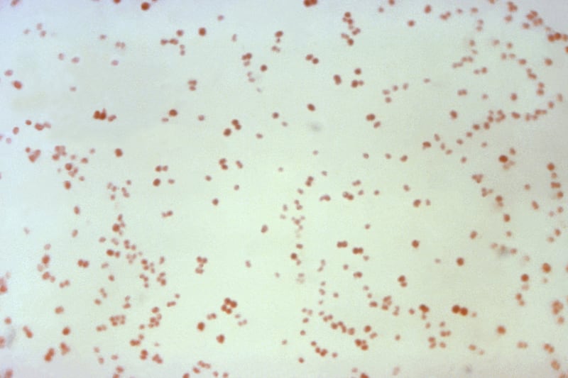 This 1971 microscope image made available by the Centers for Disease Control and Prevention shows Neisseria gonorrhoeae bacteria, which causes the sexually transmitted disease gonorrhea.
