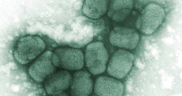 Dangerous ‘smallpox’ vial found at Merck facility. Should you worry ...