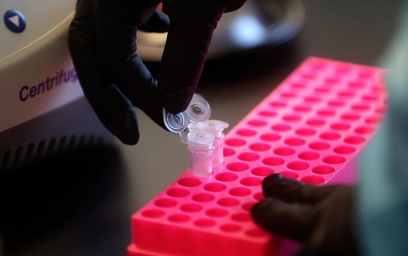 Annette Atkinson, Utah Public Health Laboratory infectious disease microbiologist, processes monkeypox test samples.