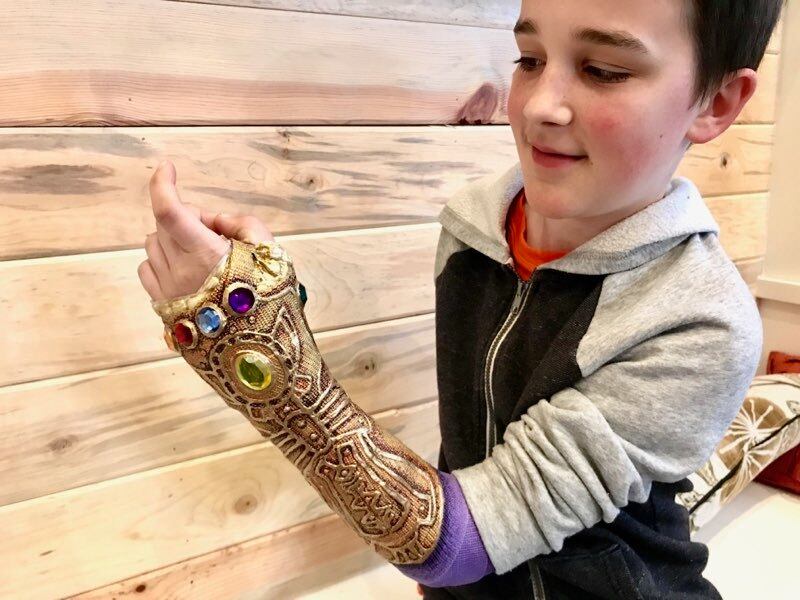 Seth Anderson attempting the Thanos Snap in his new cast.