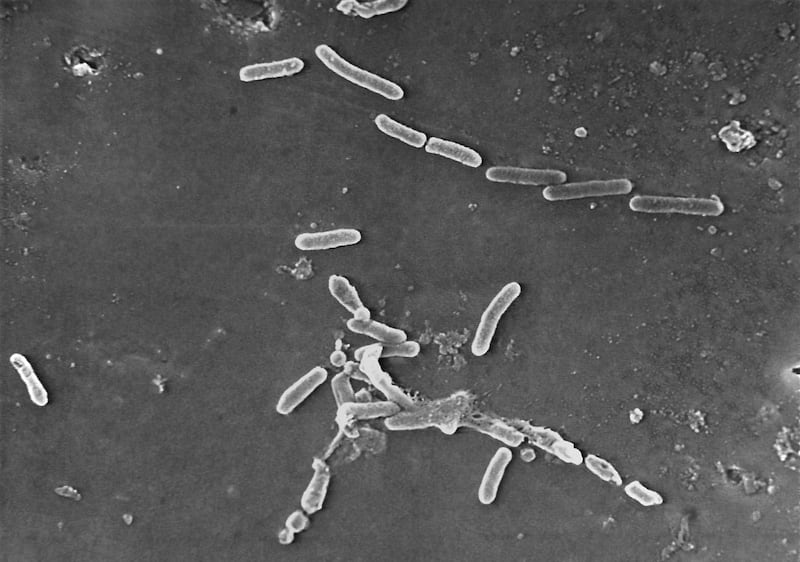 Rod-shaped Pseudomonas aeruginosa bacteria.