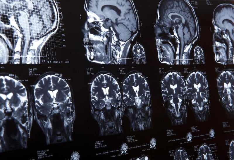 Must science be materialistic? Is the mind completely reducible to the brain? Many reputable scientists don't think so, and some have recently spoken out on the subject.