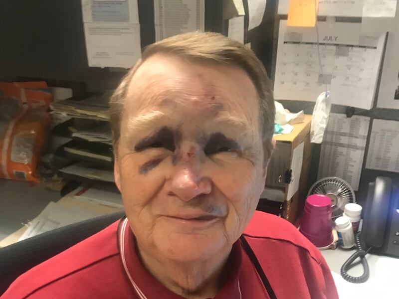 Gene Petrie, 76, sustained serious facial injuries Tuesday, July 16, 2019, when an autonomous shuttle he was riding in came to an unexpected stop. The 15-passenger vehicle was in use at the Utah State Tax Commission office in Salt Lake City, where Petrie