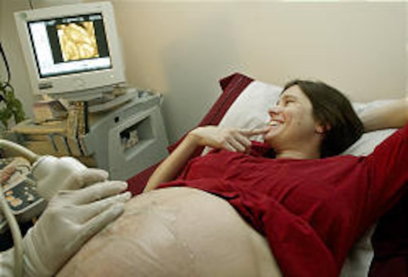 Saskia Kovac watches as a 4-D ultrasound image of her 34-week-old developing fetus is displayed on a monitor in Pasadena.