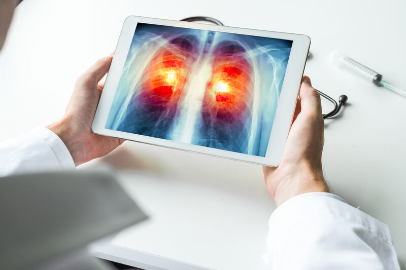 Doctor watching an X-ray of lung cancer on a digital tablet.
