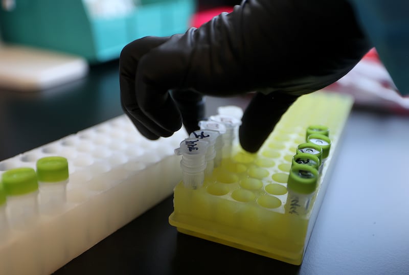 Annette Atkinson, Utah Public Health Laboratory infectious disease microbiologist, processes monkeypox test samples.