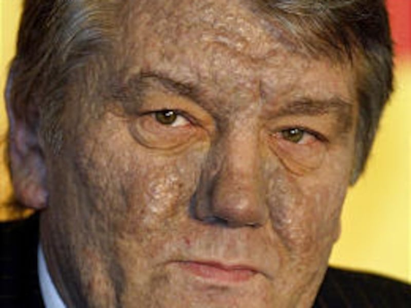 Viktor Yushchenko, with his face disfigured by dioxin poisoning, during an interview on Thursday.