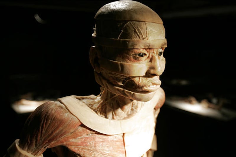 A cadaver, preserved by replacing fluids and fat with plastics, is part of the "Our Body: The Universe Within" exhibit in Arkansas.
