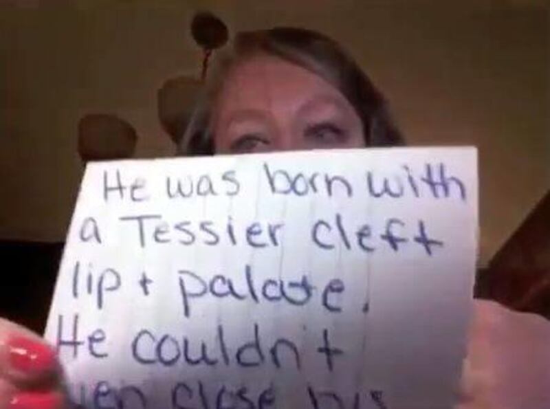 Lacey Buchanan discusses her son's rare deformity in a video.