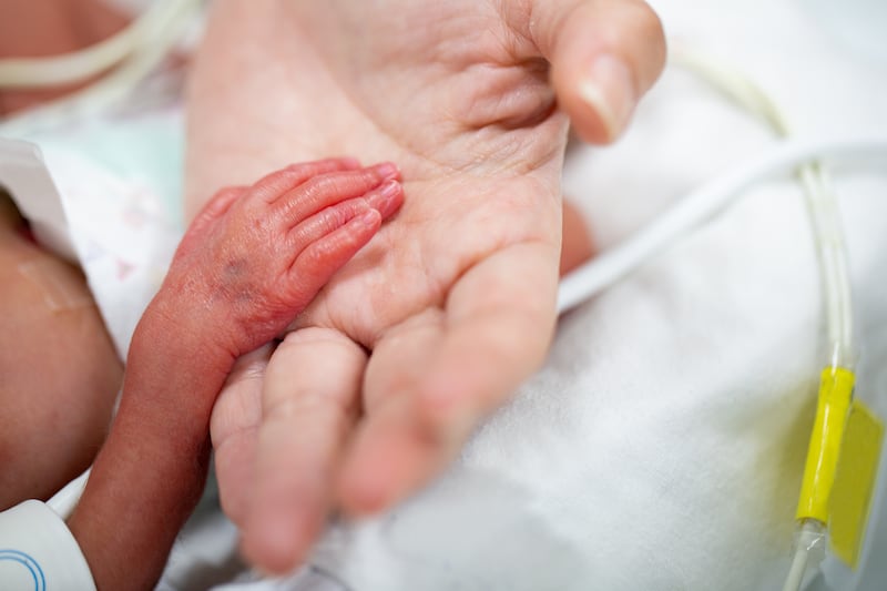 A premature baby’s hand resting in an adult’s hand is pictured.
