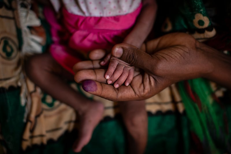 Abeba Gebru from the village of Getskimilesley, holds the hands of her malnourished daughter.