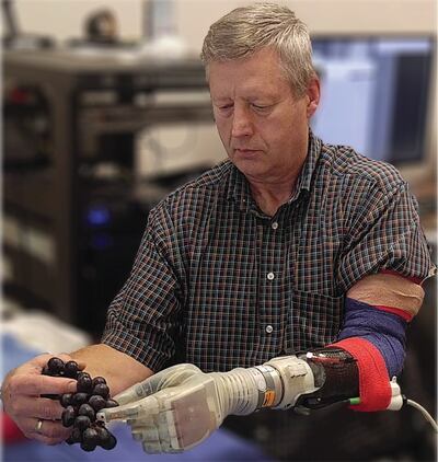 Keven Walgamott works with the LUKE arm, a prosthetic device that was used in new University of Utah research. The U. team has developed a system in which wearers of the arm can not only manipulate the device with their thoughts, but also experience a sen