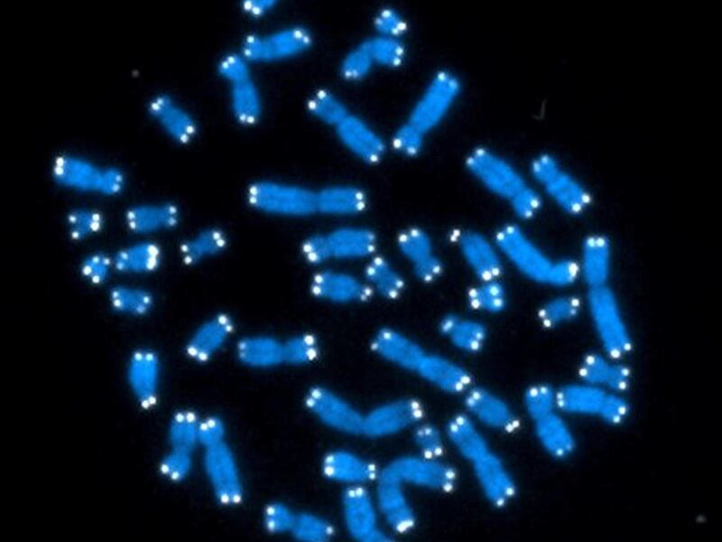 This undated image provided by the U.S. National Cancer Institute shows the 46 human chromosomes, where DNA resides and does its work. Each chromosome contains genes, but genes comprise only 2 percent of DNA. On Wednesday, Sept. 5, 2012, 500 scientists ar