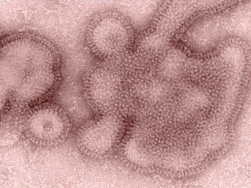 FILE - This 2011 electron microscope image provided by the Centers for Disease Control and Prevention shows H3N2 influenza virions. In January 2019, the flu season was shaping up to be one of the shortest and mildest in recent U.S. history. But a surprisi