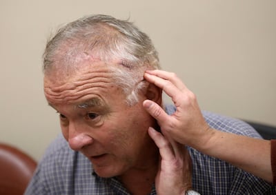 Art Eichbauer and physician assistant Meghan Zorn feel for wires beneath the skin that are part of Eichbauer's deep brain stimulator for Parkinson's treatment at the Imaging & Neurosciences Center at the University of Utah on Wednesday, Sept. 12, 2018.