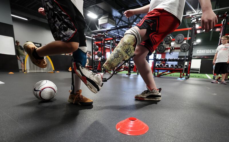Kids with prosthetic legs play a soccer game as they are assisted in reaching their running potential on Saturday as part of the Running is a Right program.