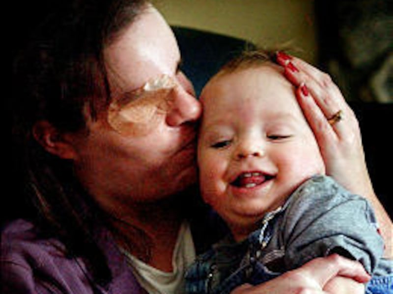 Kris Belcher's son Benjamin has inherited the gene that caused her retinal tumors, which took away the last of her eyesight. She says Benjamin "heals her heart."